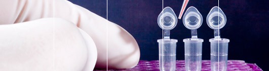 Test DNA Forensico - Campioni DNA discreti
